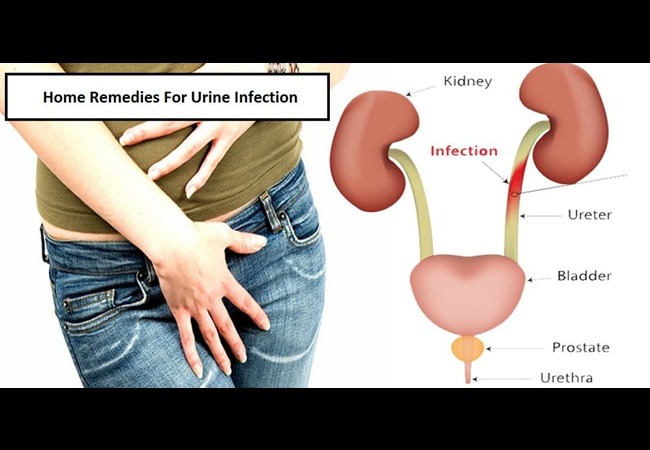 Urine Infection Symptoms