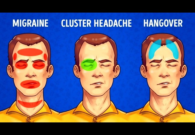 Headache Reasons