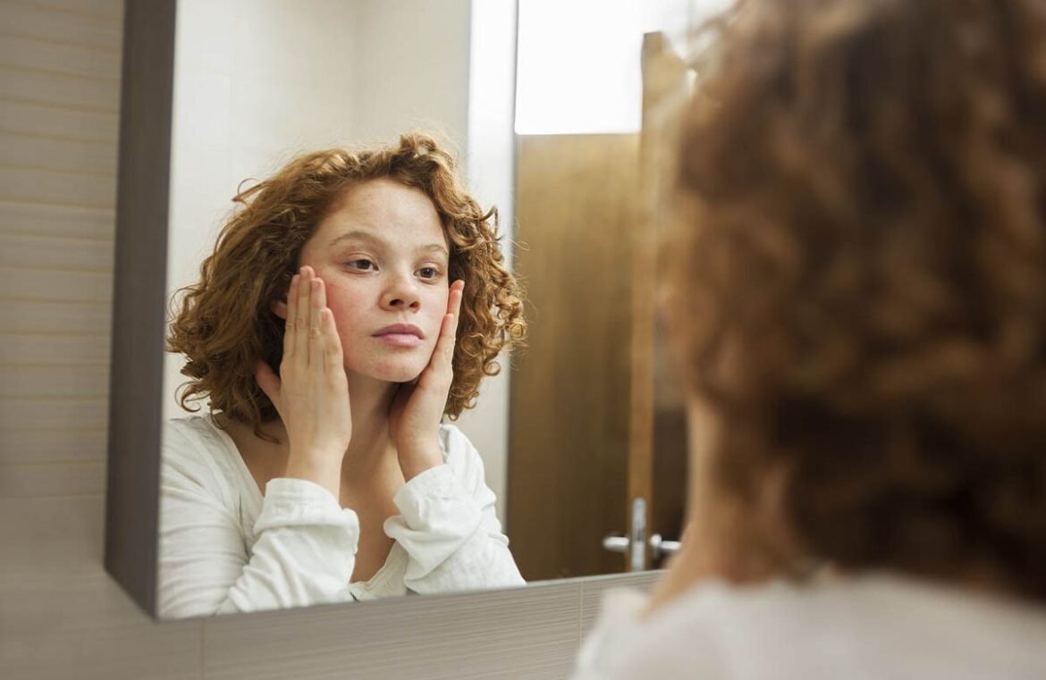 body dysmorphic disorder