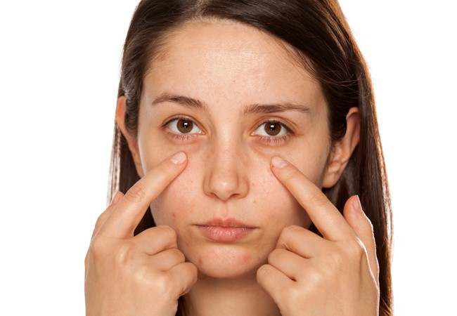 dark circles treatment