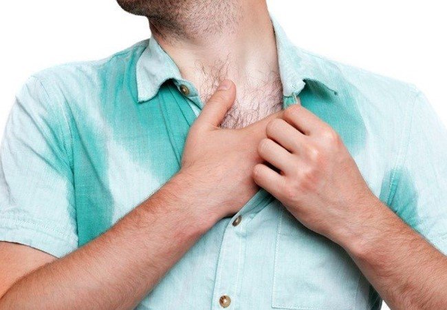 Excessive Sweating