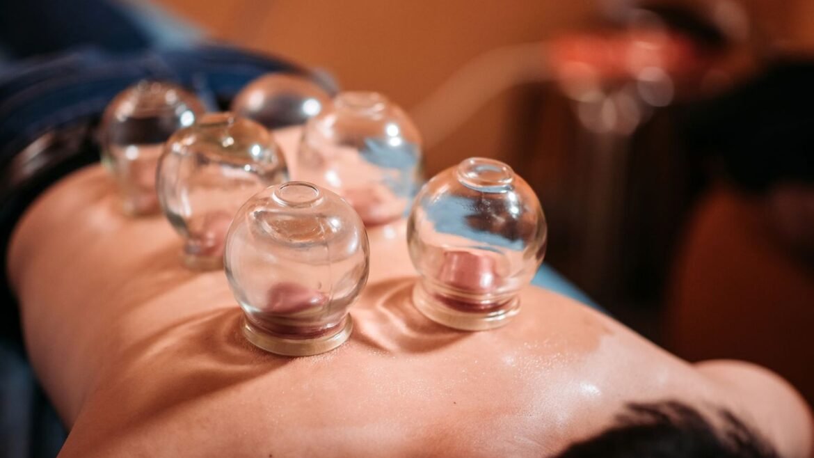 Cupping Therapy Benefits