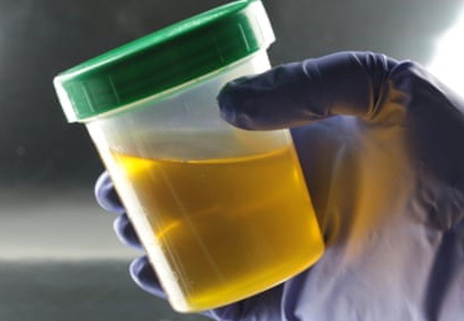 Urine Therapy
