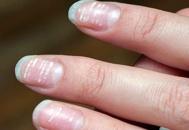 Nails