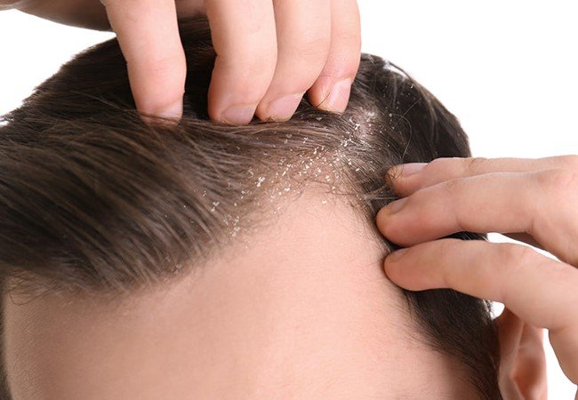 Hair Care